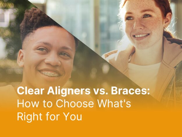 Clear Aligners vs. Braces Which is Right for You Clear Aligners vs. Braces Which is Right for You