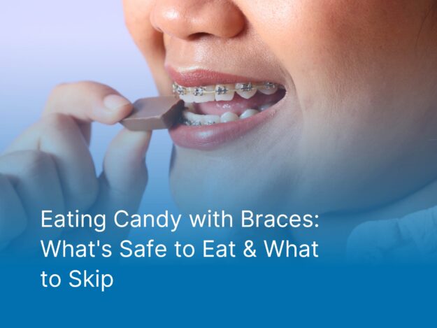 Eating Candy with Braces What’s Safe to Eat & What to Skip