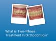 What is Two-Phase Treatment in Orthodontics?